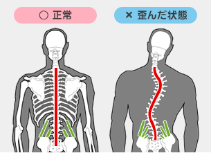 背骨矯正 京都市伏見区にある整骨院 ももやま整骨院 の背骨矯正について